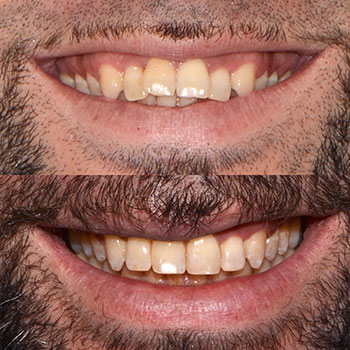 Before and After Gallery Photo Before and After Gallery Photo