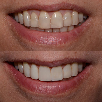 Before and After Gallery Photo Before and After Gallery Photo